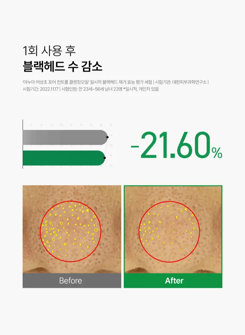 [피지순삭] 아누아 어성초 피지쏙 클렌징오일 200ml 상세페이지 15